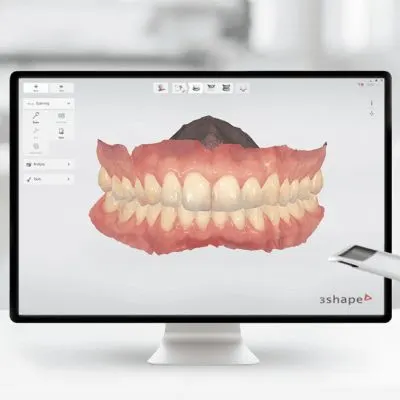 Digital teeth scanning in Tiruppur