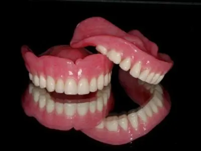 Dentures treatment by Shine Dentistry dental services Tiruppur