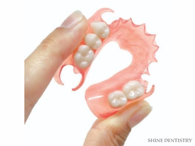 Flexible Dentures in Tiruppur - Shine Dentistry Comfortable Fit